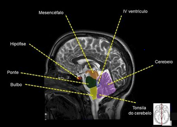 setores da radiologia 