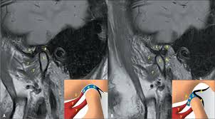 Técnica Radiológica 12