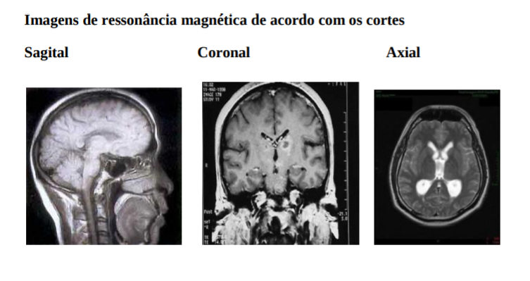Centro e periferia do Espaço K