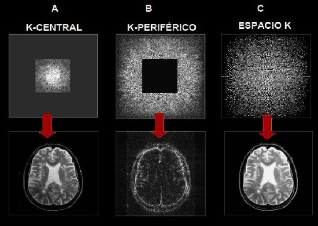 Espaço K na Ressonância Magnética