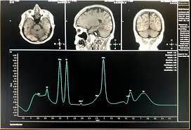 Espectroscopia por RM