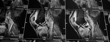 Protocolos Rápidos em RM e TC