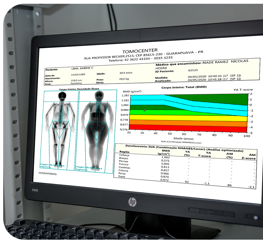 Formação da Imagem