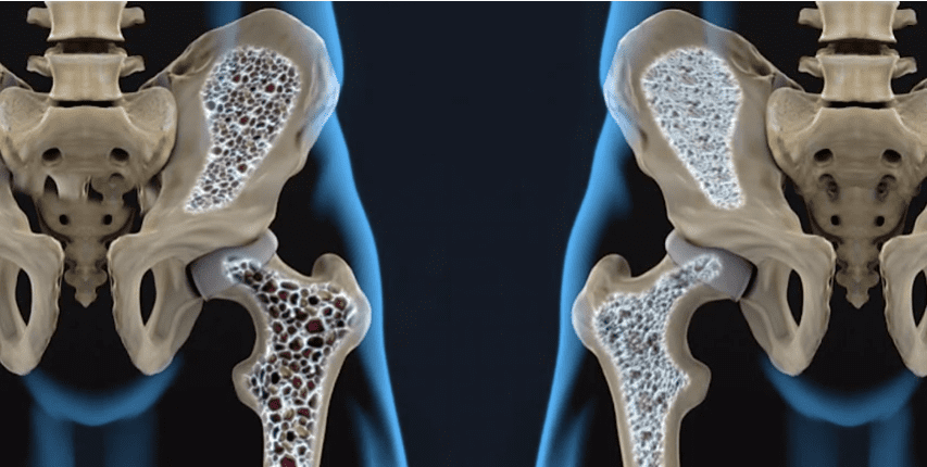 Formação da Imagem