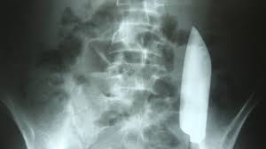 Formação da Imagem