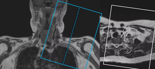 FOV, Espessura e Gap