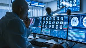 Inteligência Artificial na Radiologia