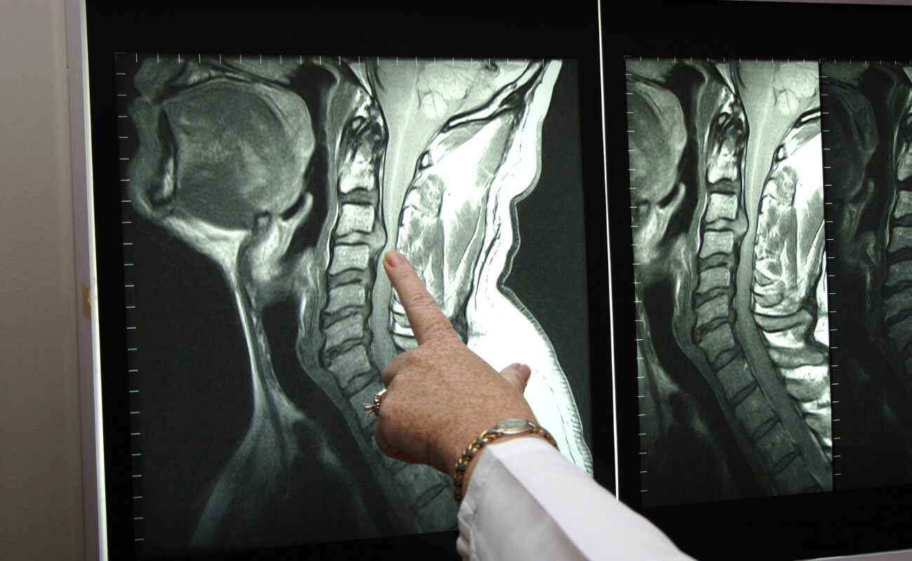 Técnica Radiológica 2