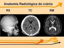 setores da radiologia 