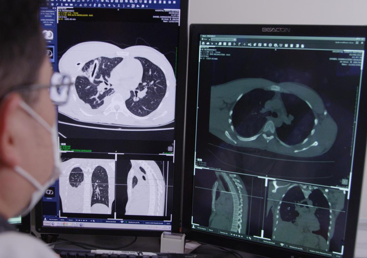 Técnica Radiológica 1