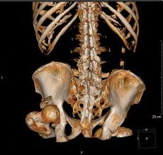 Exemplo de reconstrução 3D em face
